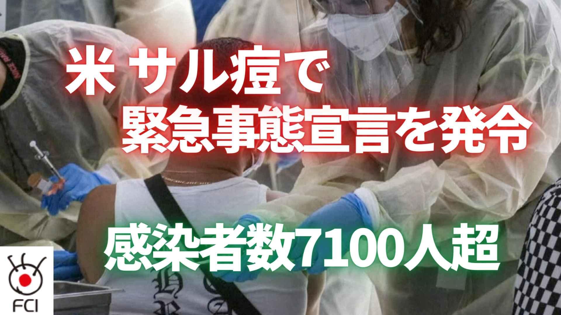米 サル痘感染者数7100人超 緊急事態宣言を発令 